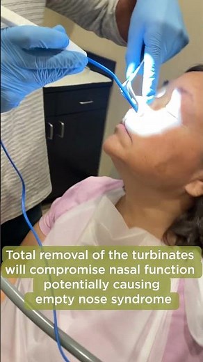 TURBINATE REDUCTION | Balloon Septoplasty [Part 2]