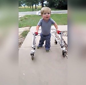 1.7M views · 16K reactions | Just an inspirational two-year-old walking unassisted after multiple heart surgeries  | UNILAD | Facebook