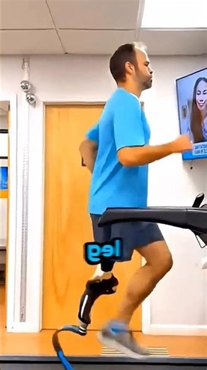 Why Do Doctors Attach Legs Backwards