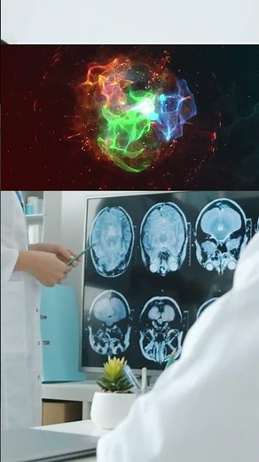 Découvrez la Clé Cachée de l'IRM ! 🔑 🤔 #imageriemédicale