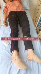 Acupuncture for constipation. Insert the needles into Zhigou (TE6) and zhaohai (KI6) with zhatiao acupuncture technique and electric stimulation. Defecation generally follows within one hour. #acupuncture 💐Learn zhatiao acupuncture technique (Muscle-Twitch Needling) :http://www.qihuanghealthcare.cn/learn/lubiao?usource=fb | Qihuang Healthcare