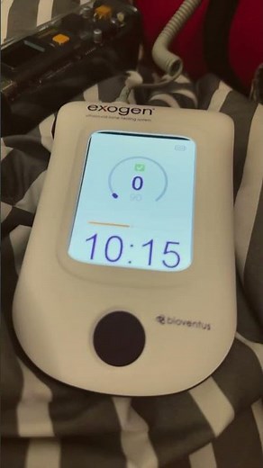 Exogen Ultrasound Bone Stimulator For My Broken Ankle