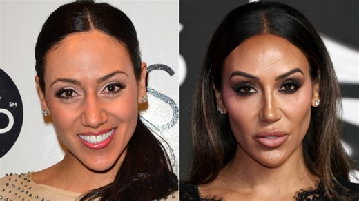 Side-by-side pics of Bravo star Melissa Gorga make her plastic surgery obvious