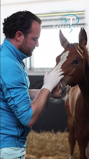 Wry nose (déviation nasale congénitale)