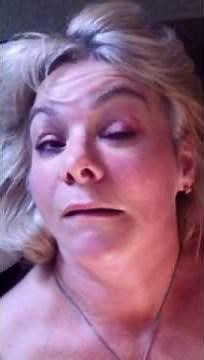 Dystonia Sufferers Blog - Facial spasm 25th May 2012