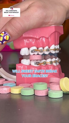 #question from @bracesbybritt CLICK TO FIND OUT 😉 #braces #bracestips #orthodontist #learnontiktok #fyp