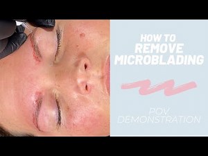 How To: Saline Tattoo Microblading Removal