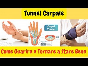 Tunnel Carpale: Sintomi, Cure Efficaci e Cosa Fare Dopo l'Intervento. #trattamento