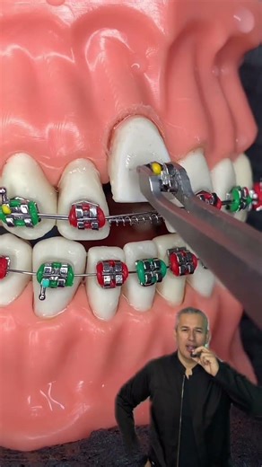 🔥Combinación de Fuerzas con los Brackets🔥