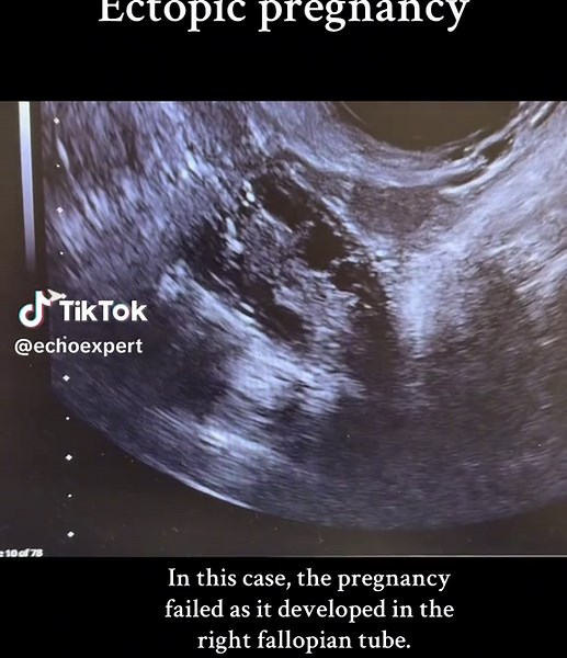 EchoExpert on TikTok