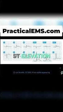 EKG Changes Reveal Pericarditis in Young Patient #shorts