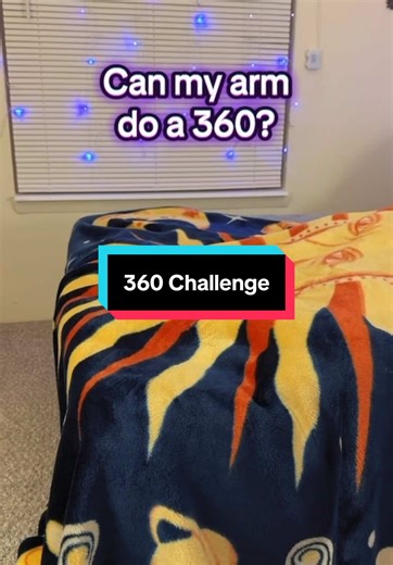 I remember growing up, I would just do certain things like normal, and people would look at my arm and be like “eww why does your arm do that!” And I was like “I don’t know”. I used to think something was wrong with my arms lol. Then I found out what double jointed was