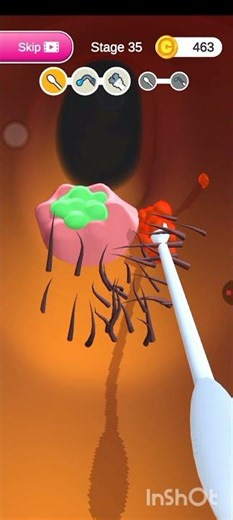 Ear Doctor Game #gaming