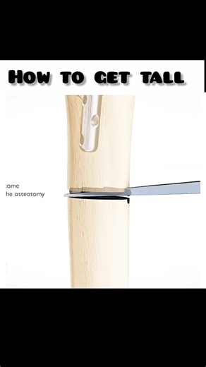 My leg start dance 🕺🏽 #howtogettall #foryou #funnyimages #relatable #funnymemes #funny #funnypost