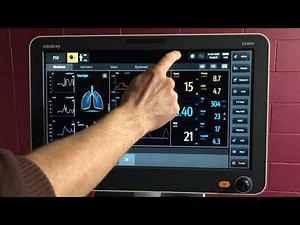 Mindray SV800 Alarm management