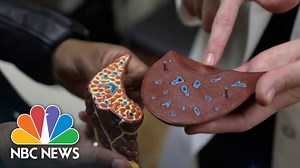 Unique program combines treatments for alcohol-related liver disease and addiction - The Global Herald