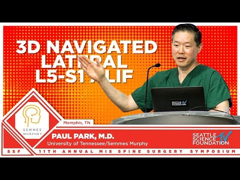 3D Navigated Lateral L5 S1 ALIF - Paul Park, M.D.