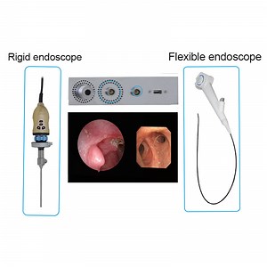 [Hot Item] One Click Switch Between Flexible Endoscope and Rigid Endoscope