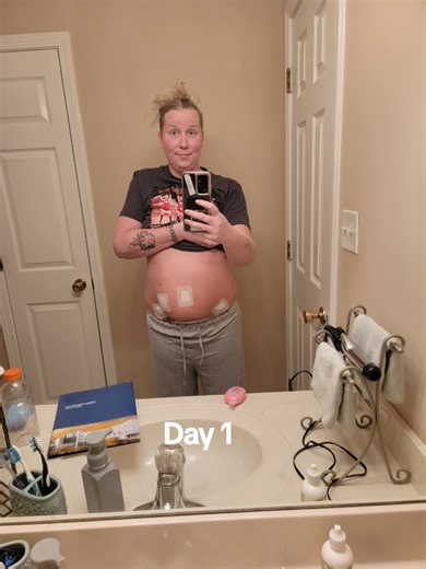 Emotional Journey of Total Hysterectomy Recovery