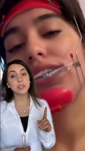 Headgear for an underbite! #braces #dentist #headgear #underbite #smilemakeover