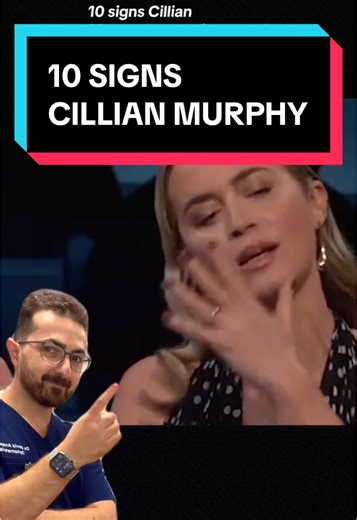 10 Signs Cillian Murphy May Need Prism Lenses