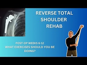 Reverse Total Shoulder Replacement Therapy, post op weeks 6 12. What Exercises Should You be Doing?