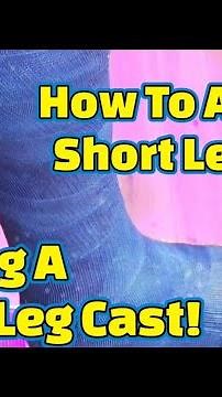 Getting A Short Leg Cast! How To Apply A Short Leg Cast Step By Step!