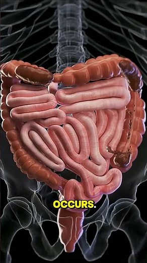 Digestive System Animation | Constipation Explained"