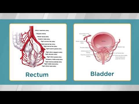 Understanding Potential Complications and Risks of PAE