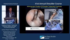 Arthroscopic Fixation of Greater Tuberosity Fractures: When and How to Do It