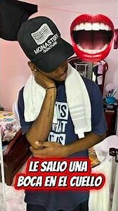Le salió una boca en el cuello 😱 #viral #fyp #parati #youtubeshorts #shorts