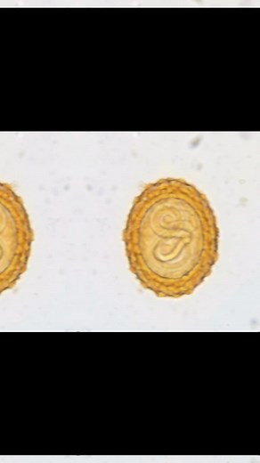 Stool Examination: Identify Parasite Ova