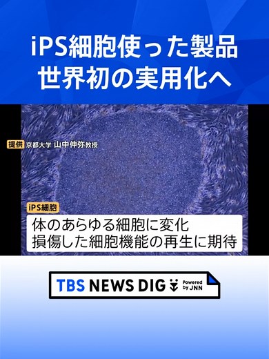 iPS細胞を用いた再生医療製品が実用化へ