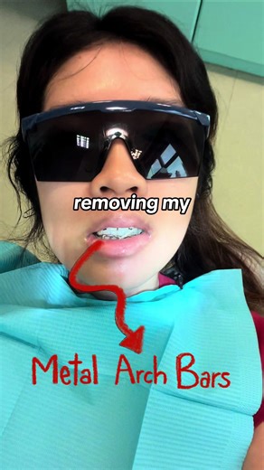 one more week of purée diet before i transit to soft food diet! #orthognathic #surgeryrecovery