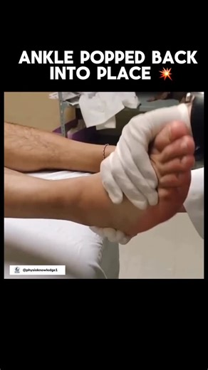 PHYSIO KNOWLEDGE1 on Instagram: "PAINFUL ANKLE DISLOCATION 👣 An ankle dislocation is one of the most severe joint injuries — usually caused by high-impact trauma like sports injuries, falls, or road accidents. It happens when the talus bone shifts out of its normal position, often accompanied by ligament tears. Symptoms: 🔥 Intense pain 🔥 Visible deformity 🔥 Swelling + bruising 🔥 Inability to bear weight #physiotherapymanagement #physiotherapyday #physicaltherapist #reel #area #physiopathway