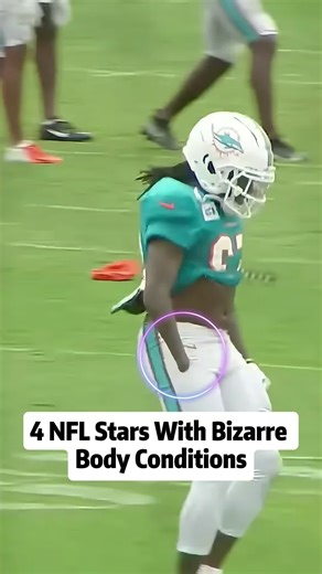 #creatorsearchinsights 4 NFL Stars With Bizarre BodyConditions #nfl #nffootball #dkmetcalf #steelers