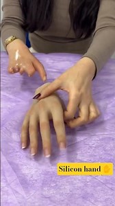 Life After Hand Amputation | Advanced Artificial Hand Prosthetic #nevergiveup