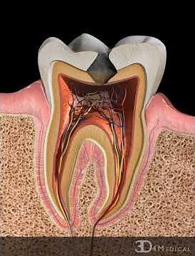Pulpotomy
