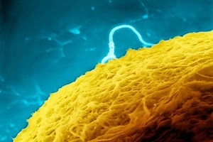 Wallpaper fungus can make you sick according to study