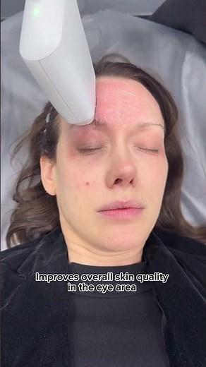 What SOFWAVE does for each part of the Face/ Body? | Dr. MediSpa