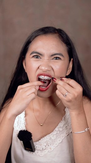 Floss for Braces: Tips and Techniques for Effective Use