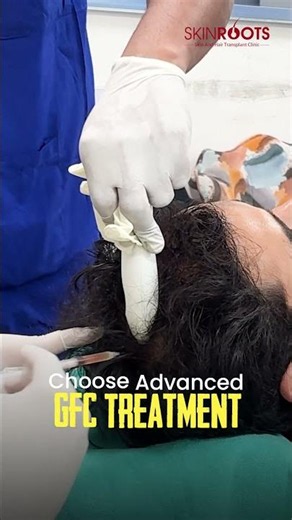 Advanced GFC Hair Fall Treatment Procedure at Skinroots Clinic