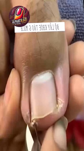 704. How employers gain from preventive health routines #WorkplaceWellness #EverydayWellness #HealthyHabits | AlphaOt 8.60