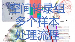 5. 多个空转样本处理流程, 空间转录组/结合单细胞转录组/入门必看/标准分析流程/实战为主/保姆级教程/生物信息学/R语言/生信分析/单细胞/转录组