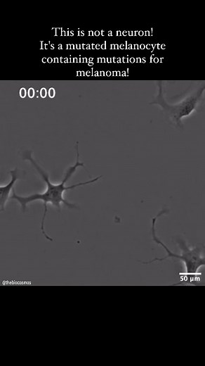 TheBioCosmos on Instagram: "This cell used to be a melanocyte. Melanocytes are the pigment cells in your skin that produce melanin to protect your skin from UV radiation. When mutated, melanocytes give rise to the most dangerous form of skin cancer known as melanoma. In the lab, one way to study melanoma is to take a normal melanocyte cell, and then introduce specific mutated genes that we normally find in a melanoma cell into this cell, and transform normal melanocytes into melanoma-liked cells