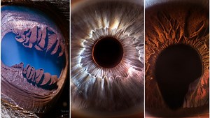Suren Manvelyan: The Person Behind ‘Your Beautiful Eyes’ Extreme Macro Photography | Fstoppers