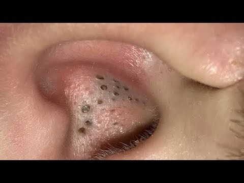 Learning Arithmetic One Concept at a Time | GPS Network