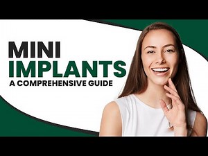 Mini Implants: A Comprehensive Guide