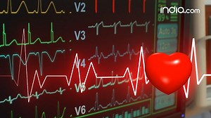This Smartphone App Can Detect Heart Attack #HeartStrokeApp #Stroke #Smartphones #Health #Lifestyle | India.com | Facebook