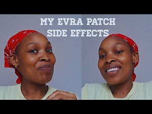 My experience with the Evra patch | Contraceptives and their side effects | Navigating Birth control